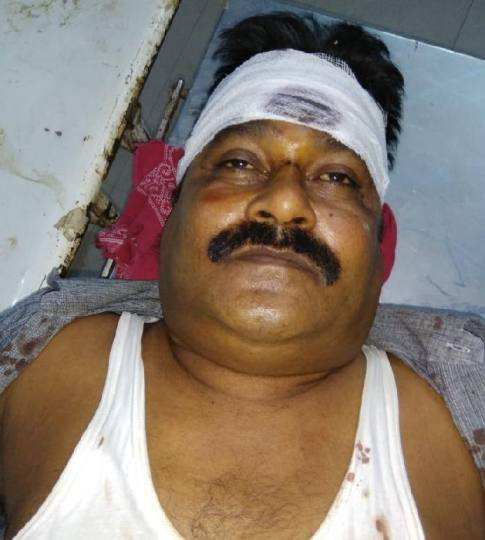 कांग्रेस के ब्लॉक अध्यक्ष पर हमला, डंडे से सिर फोड़ा
