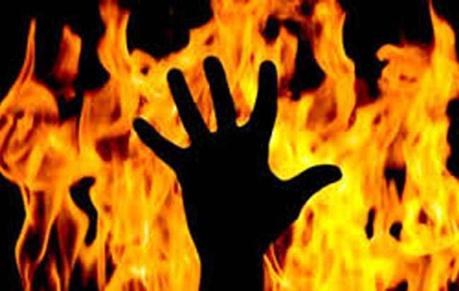 आजमगढ़ में आग से झुलसी महिला की मौत, तीन दिन पूर्व अस्पताल में हुई थी भर्ती