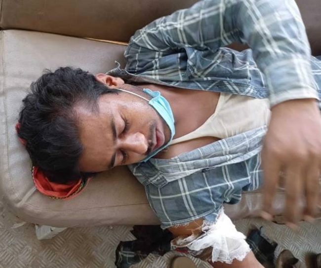 बाइक सवार युवक को बदमाशों ने मारी गोली, भर्ती