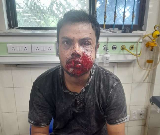 फिल्मी अंदाज में मुंबई के युवक को लेकर आए दोस्तों ने मारी गोली, हालत गंभीर Aligarh news