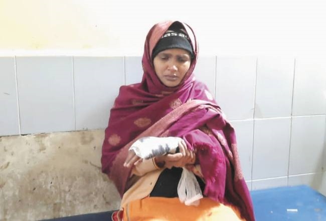 झाडू लगा रही महिला को हाथ में मारी गोली