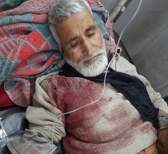 पतंगबाजी के विवाद में किया था युवक पर हमला, 12 पर केस