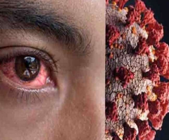Black Fungus Meerut News: मेरठ में ब्लैक फंगस के छह नए मरीज,कोरोना के 16 मामले,एक की मौत
