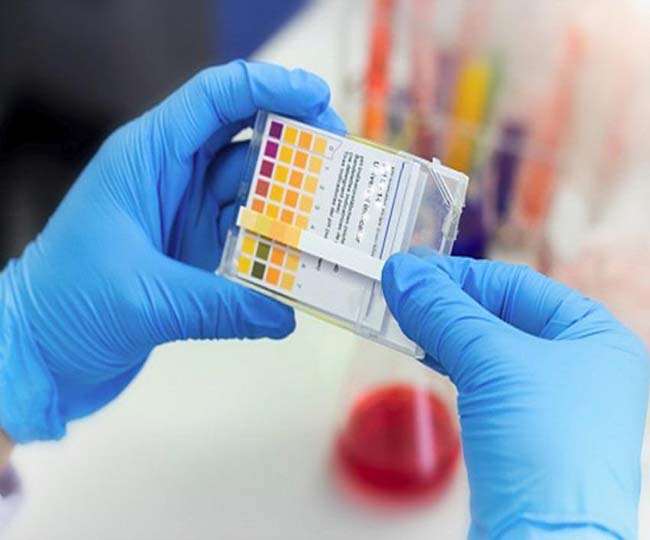 Covid-19: आप के अंदर छिपी बीमारी की जासूसी करने आ गया फेलू दा, हैरान करने वाली है इनकी ध्राण शक्ति