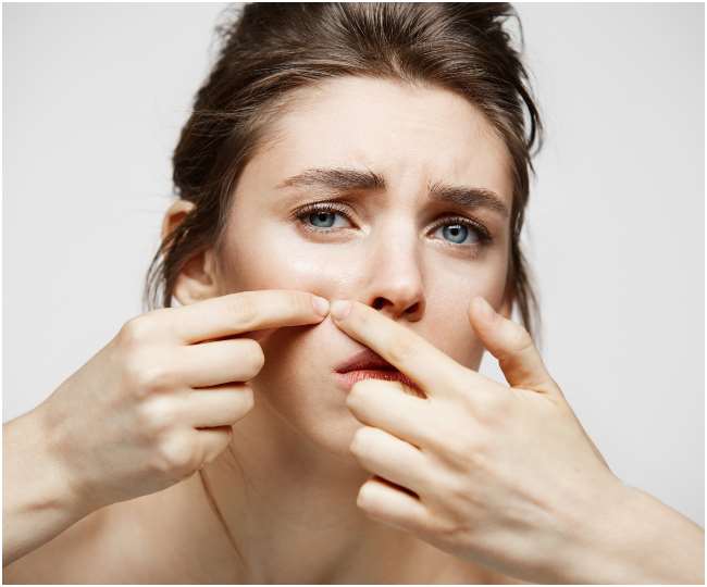 Acne Tips: चेहरे पर मुंहासों से हैं परेशान, तो आपके काम आएंगी ये 5 आसान टिप्स