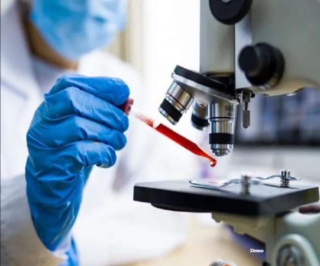 Moradabad coronavirus news : कोरोना संक्रमण से ठीक हुए मरीजों से होगी पूछताछ, जानिए क्या है वजह