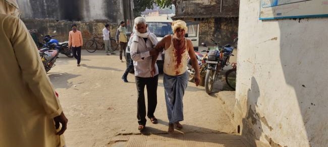 रास्ते से भैंस हटाने को कहा तो जमकर चलीं लाठियां, छह लोग हुए घायल