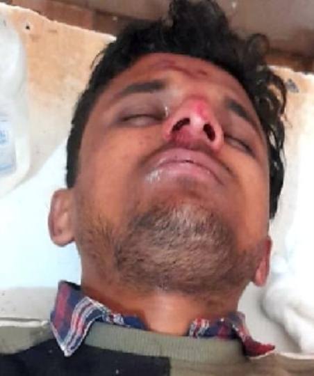 ट्रैक्टर की चपेट में आने से छात्र गंभीर घायल, सीएचसी में कराया भर्ती