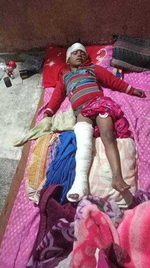 चालकों की लापरवाही पड़ी भारी, एक को कार ने और एक को स्कूटी सवार ने टक्कर मारी
