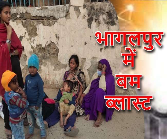 भागलपुर में फिर से बम विस्फोट: हबीबपुर के करोड़ी बाजार में कूड़े में रखा बम फटा, दो बच्चे जख्मी