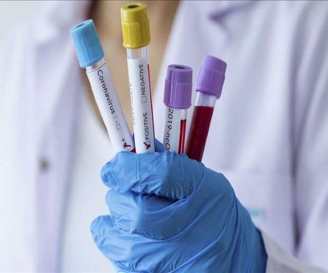 रायबेरली में चार जमातियों समेत आठ नए कोरोना पॉजिटिव, कृपालु इंस्टीट्यूट में भर्ती
