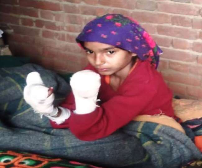 चारा काटने में पिता की सहायता रही मासूम के मशीन से दोनों हाथ कटे