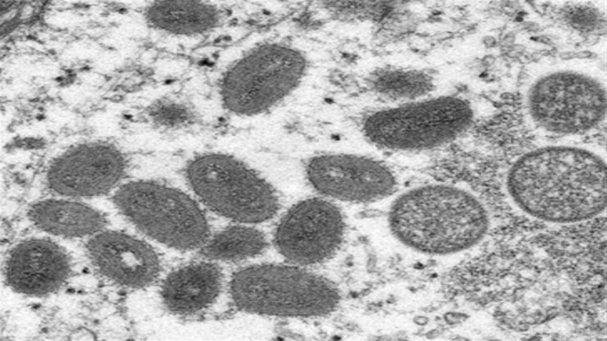 WHO on Monkeypox: मंकीपाक्स को लेकर घोषित किया जा सकता है वैश्विक आपातकाल, डब्ल्यूएचओ लेगा फैसला