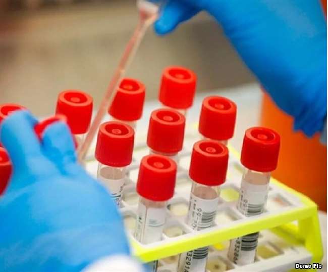 राहत भरी खबर, यमुनानगर में 5 निजी लैब कोविड टेस्ट के लिए अधिकृत