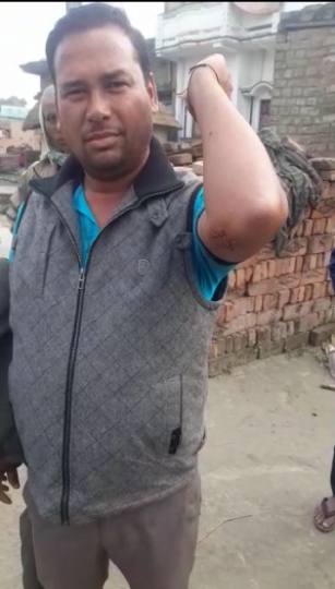 अहियापुर में पागल बंदर का आतंक, चार को किया जख्मी