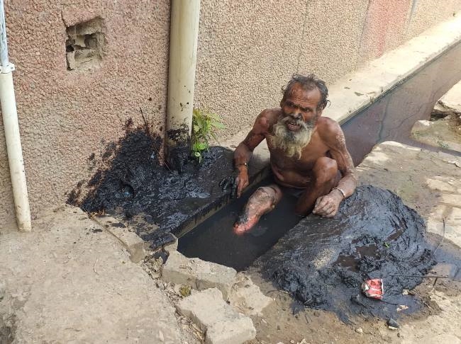 मेडिकल कालेज में जलन से तड़प कर नाली में पड़ा रहा मरीज