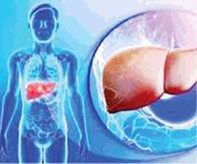 World Hepatitis Day 2021: पढि़ए इसके लक्षण और प्रकार, पानीपत में हार रहा है ये रोग