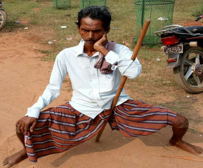 Chakulia, Jamshedpur Samachar: दिव्यांग डमन पातर को पेंशन की टेंशन, 26 माह से खाते में नहीं आई पेंशन की राशि