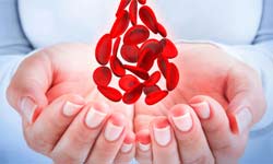 World Hemophilia Day 2017 Know The Hemophilia And How To get Prevention World Hemophilia Day 2017 Know The Hemophilia And How To get Prevention