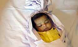 After successful heart surgery in India, Pakistani baby Rohaan dies of dehydration After successful heart surgery in India, Pakistani baby Rohaan dies of dehydration