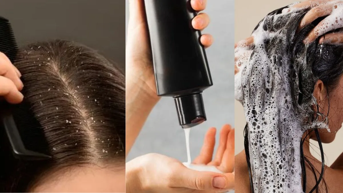 बेस्ट एंटी डैंड्रफ शैम्पू