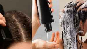 बेस्ट एंटी डैंड्रफ शैम्पू