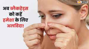 ब्लैकहेड्स को कैसे हटाएं