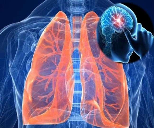 Lung cancer strikes the brain