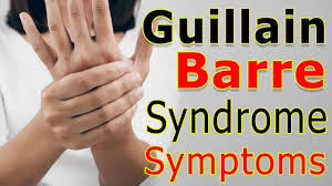 Knock The Guillain Barre Syndrome In City Know Who Is This And What Are The Measures To Avoid