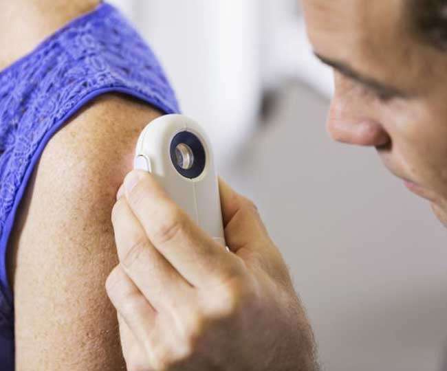 Melanoma gyanúja merre menjen. Májrák, májáttét | Rákgyógyítás