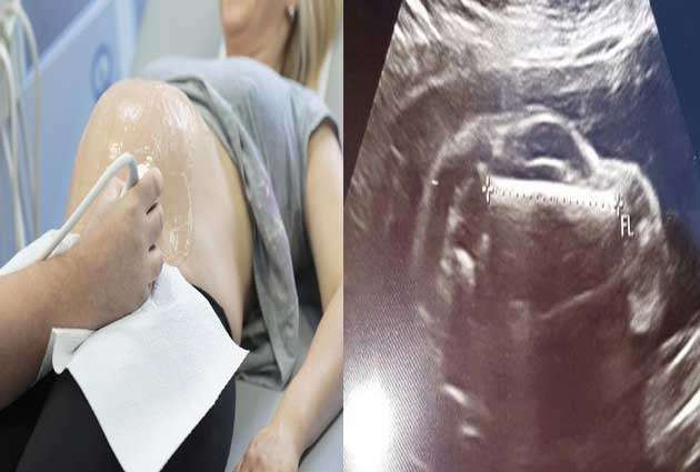 प्रेग्नेंट बीवी का अल्ट्रासाउंड कराने गए शख्स के उड़े होश, बच्चे की जगह दिखी स्पोर्ट्स कार