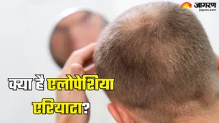 हल्के में न लें लगातार झड़ते बाल (Picture Credit- Freepik)