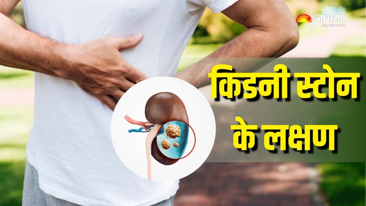 https://www.jagranimages.com/images/2025/06/21/article/image/Kidney-Stones-Symptoms-(1)-1750502187418.jpg