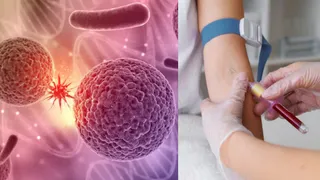अब तीन साल पहले कैंसर का पता चल सकेगा। Image Credit- Freepik