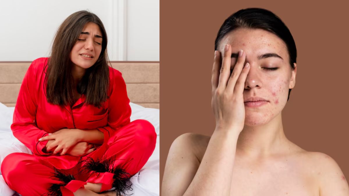 https://www.jagranimages.com/images/2025/06/21/article/image/periods-and-skin-care-1750478408127.jpg