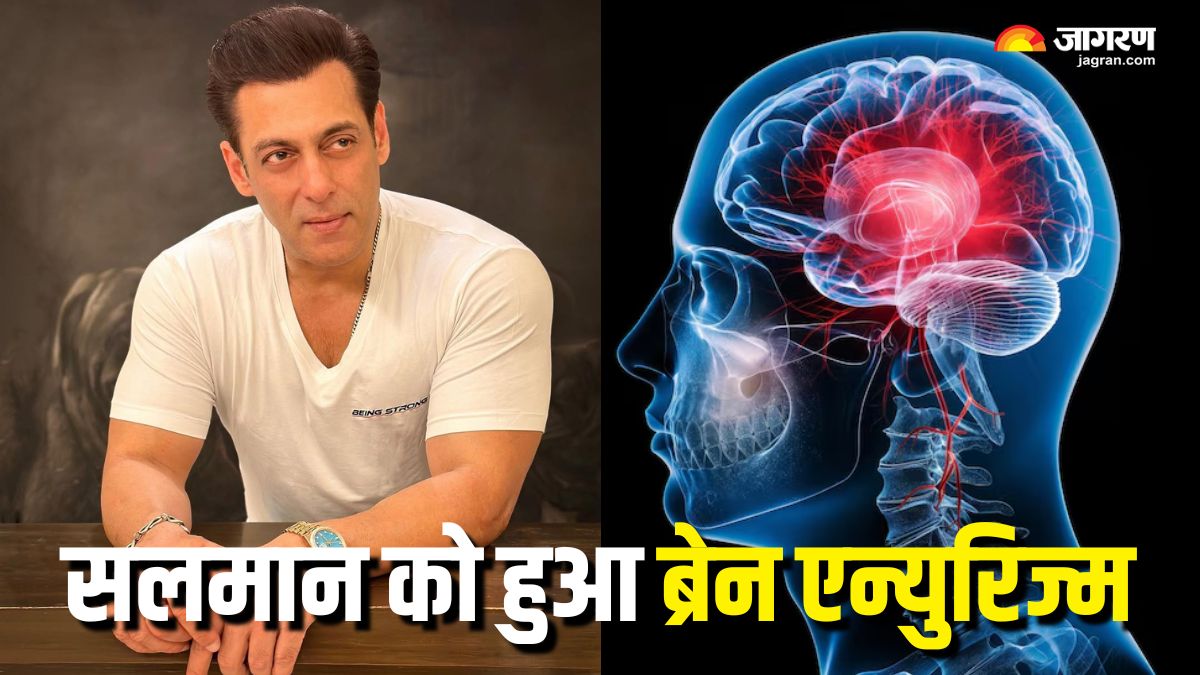 https://www.jagranimages.com/images/2025/06/23/article/image/Salman-Khan-Brain-Aneurysm-1750663920288.jpg