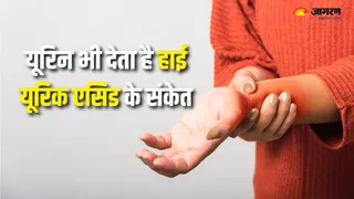 Uric Acid बढ़ने पर दिखाई देते हैं ये लक्षण (Picture Courtesy: Freepik)