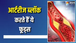 आर्टरीज को ब्लॉक होने से बढ़ता है हार्ट अटैक का रिस्क (Picture Courtesy: Freepik)