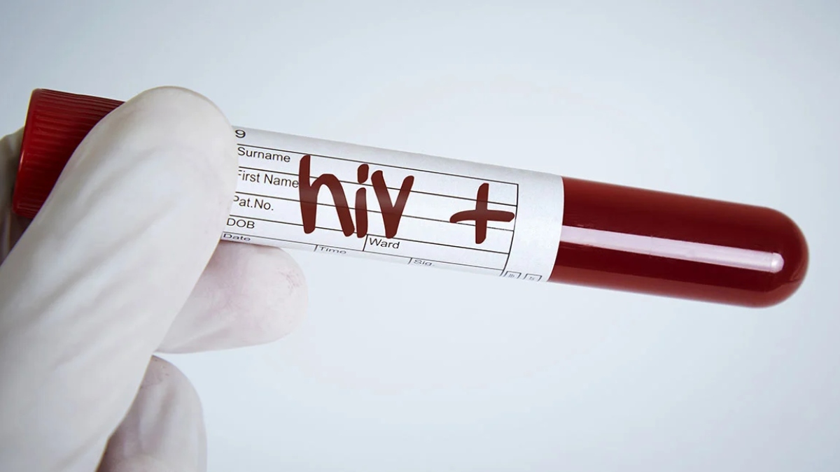 hospital reveals identity of hiv patient high court says it is inhuman