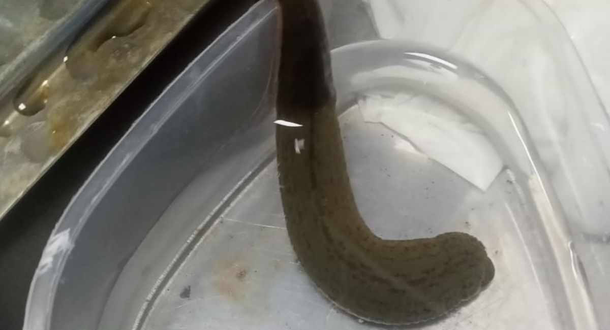 leech therapy in plastic surgery brd medical college initiative