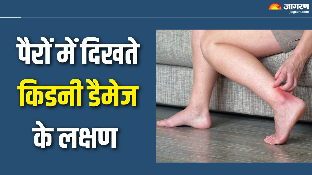 symptoms of kidney diseases in legs do not ignore these signs