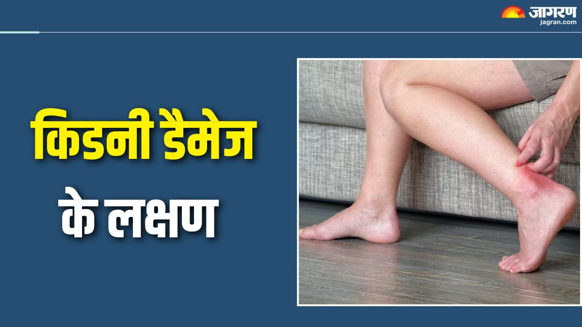 symptoms of kidney diseases in legs do not ignore these signs