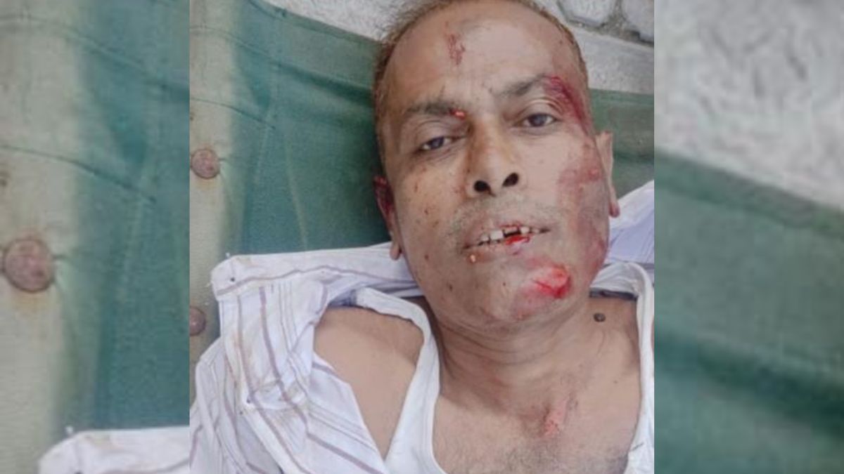 rpf jawan loses leg in ghaziabad 16 cops become lifesavers