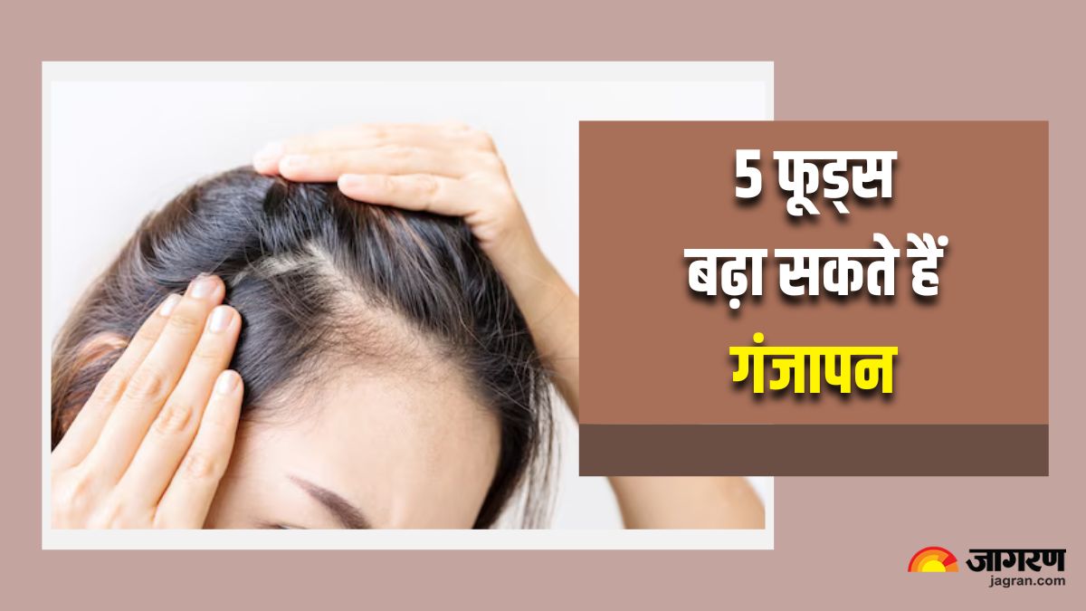 5 foods that can increase hair fall are you making this mistake