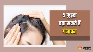 कहीं आपके झड़ते बालों का कारण ये 5 फूड्स तो नहीं? (Image Source: Freepik)