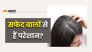 कम उम्र में ही सफेद हो रहे हैं बाल... कहीं इस विटामिन की कमी तो नहीं? (Image Source: Freepik)