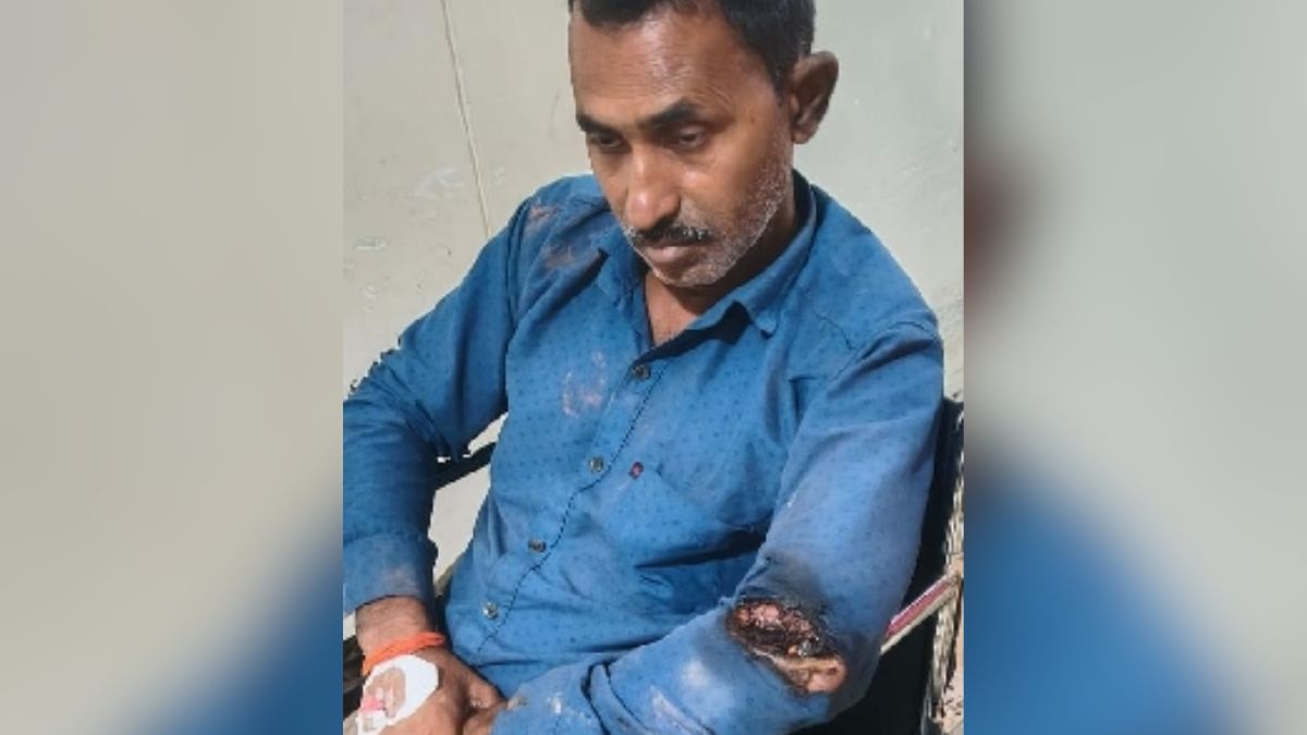 tragedy in kushinagar father dies of electrocution son brother injured