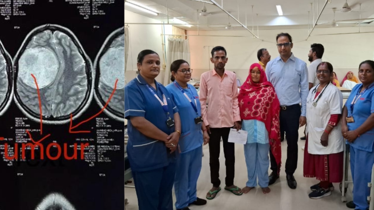 neurosurgeon dr ar gauri performed complex surgery 9cm large tumor removed