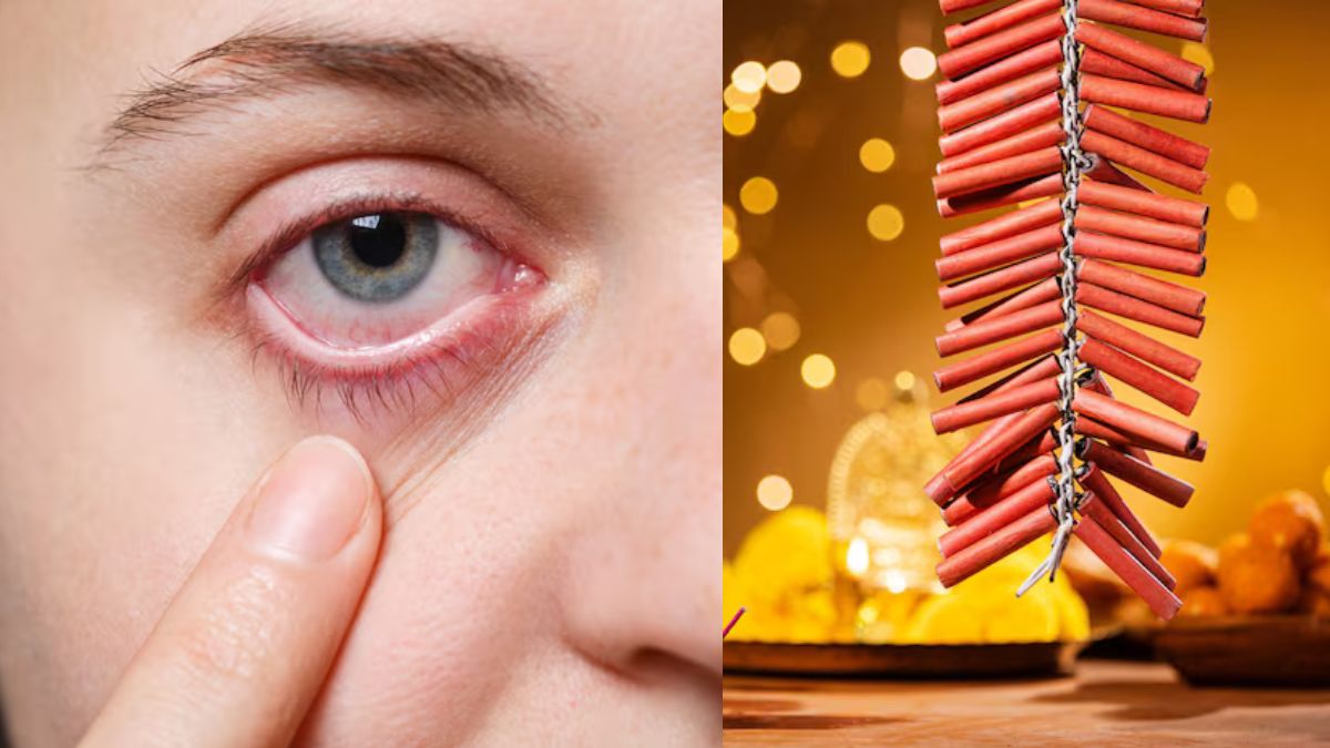 diwali 2025 5 tips to protect eyes from firecrackers smoke check details here