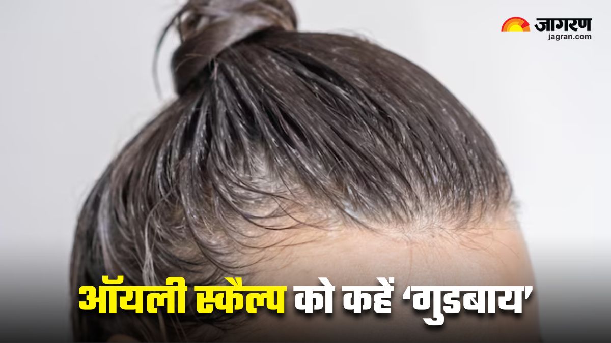 5 home remedies to get an oil free scalp for the festive season